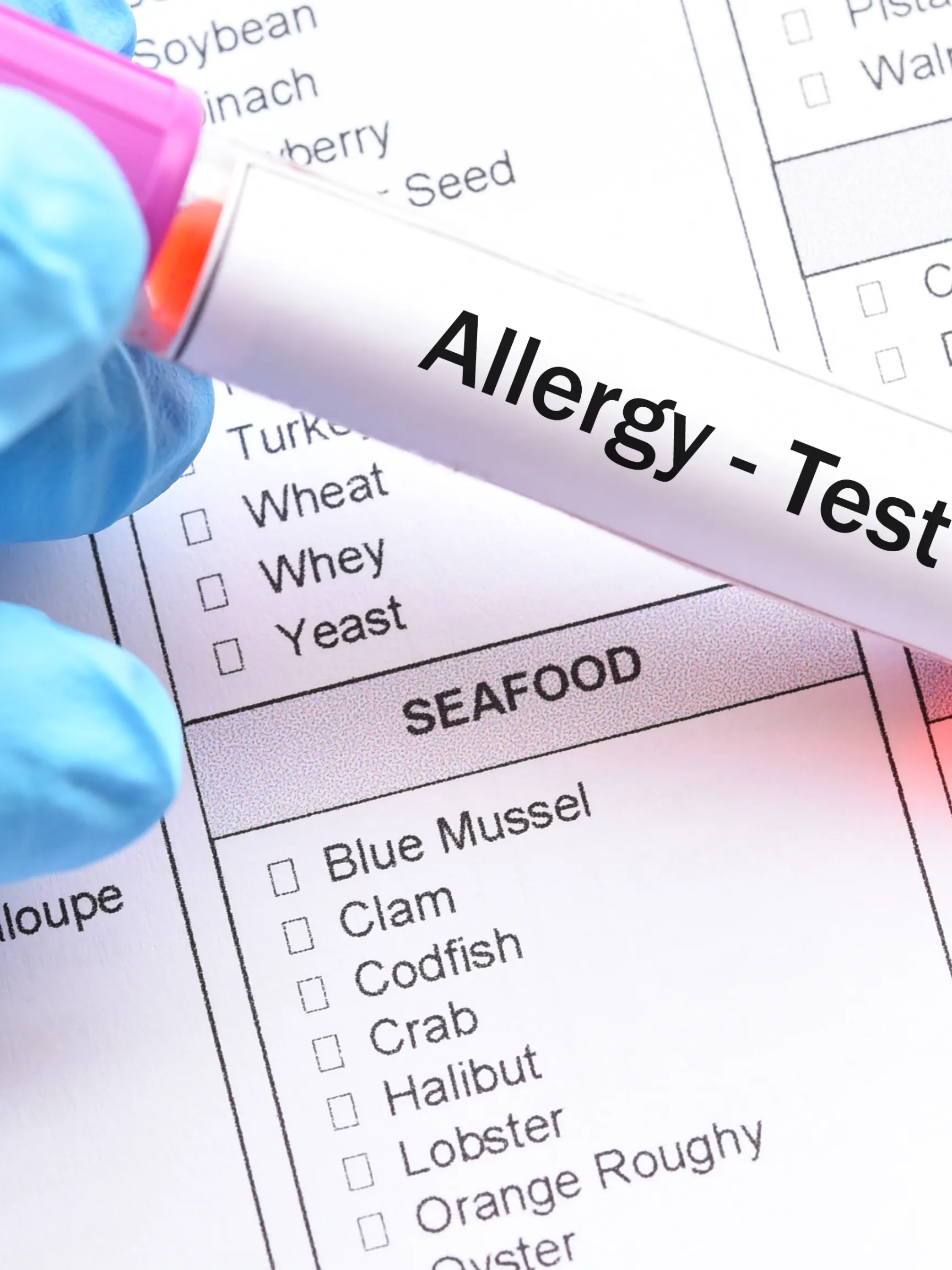 IgG Food Sensitivity Testing